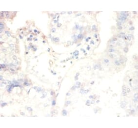 Immunohistochemistry - Casein kinase II subunit beta Polyclonal Antibody from Signalway Antibody - Antibodies.com