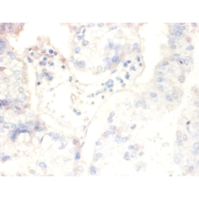 Immunohistochemistry - Casein kinase II subunit beta Polyclonal Antibody from Signalway Antibody - Antibodies.com