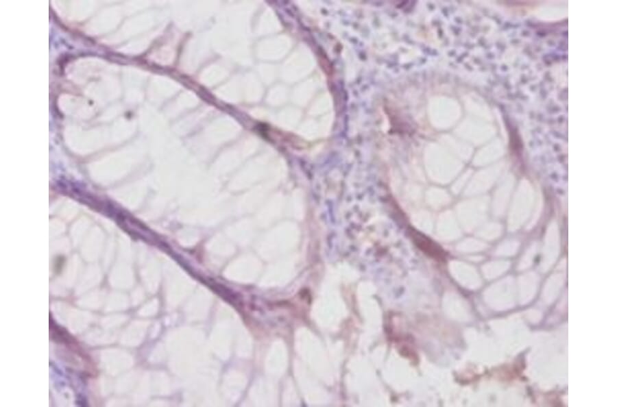 Immunohistochemistry - Metalloproteinase inhibitor 4 Polyclonal Antibody from Signalway Antibody - Antibodies.com