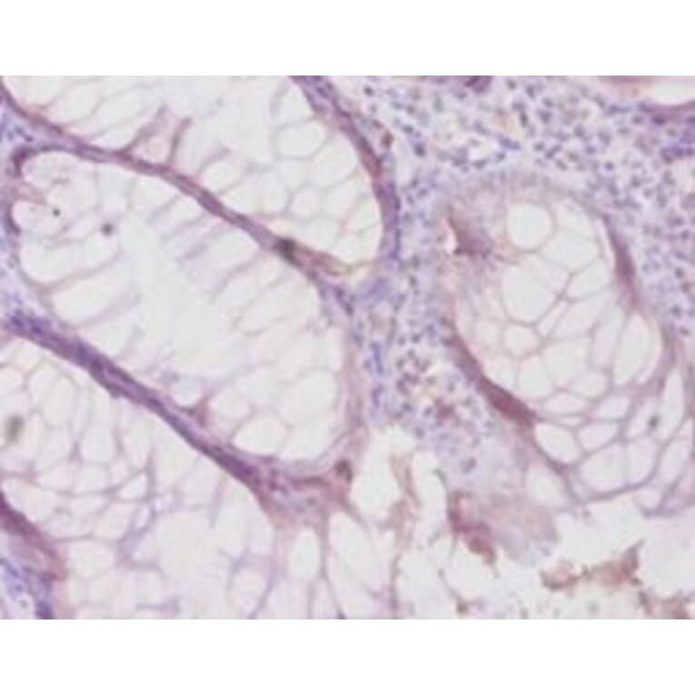 Immunohistochemistry - Metalloproteinase inhibitor 4 Polyclonal Antibody from Signalway Antibody - Antibodies.com