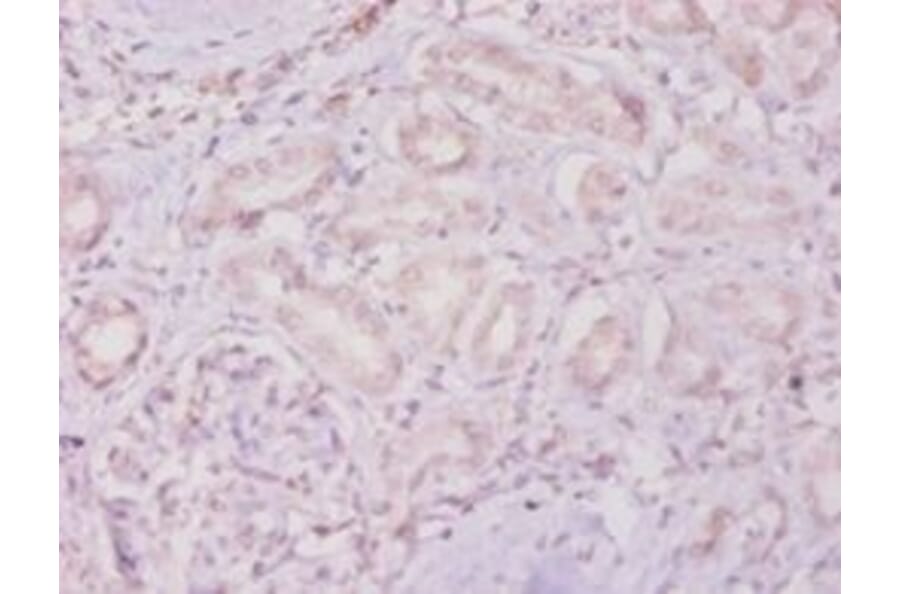 Immunohistochemistry - Metalloproteinase inhibitor 4 Polyclonal Antibody from Signalway Antibody - Antibodies.com