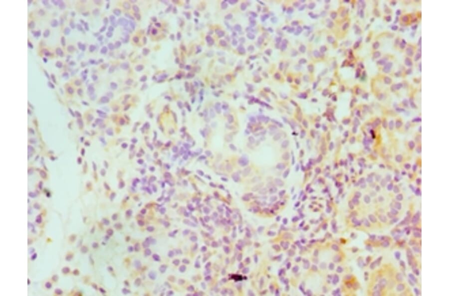 Immunohistochemistry - SERPINA4 Polyclonal Antibody from Signalway Antibody (42320) - Antibodies.com