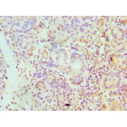 Immunohistochemistry - SERPINA4 Polyclonal Antibody from Signalway Antibody (42320) - Antibodies.com