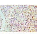 Immunohistochemistry - SERPINA4 Polyclonal Antibody from Signalway Antibody (42320) - Antibodies.com