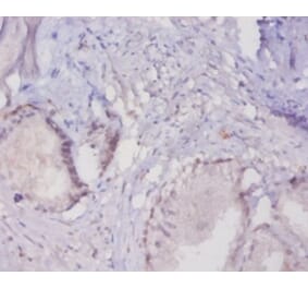 Immunohistochemistry - Mucin-16 Polyclonal Antibody from Signalway Antibody (42528) - Antibodies.com