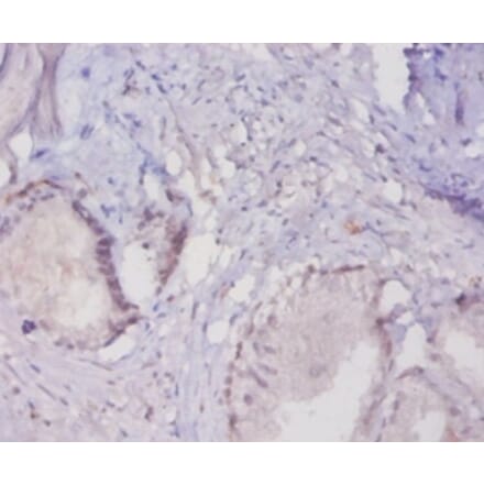 Immunohistochemistry - Mucin-16 Polyclonal Antibody from Signalway Antibody (42528) - Antibodies.com
