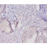 Immunohistochemistry - Mucin-16 Polyclonal Antibody from Signalway Antibody (42528) - Antibodies.com