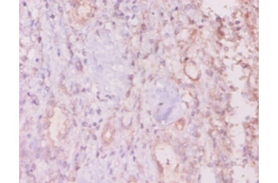 Immunohistochemistry - Mucin-16 Polyclonal Antibody from Signalway Antibody (42528) - Antibodies.com