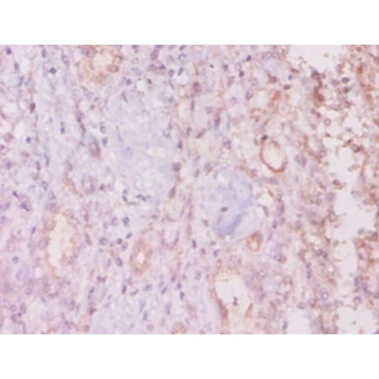 Immunohistochemistry - Mucin-16 Polyclonal Antibody from Signalway Antibody (42528) - Antibodies.com