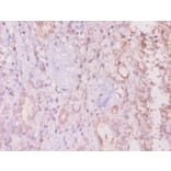 Immunohistochemistry - Mucin-16 Polyclonal Antibody from Signalway Antibody (42528) - Antibodies.com