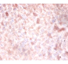 Immunohistochemistry - DNA (cytosine-5) methyltransferase3A Polyclonal Antibody from Signalway Antibody (42151)