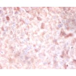 Immunohistochemistry - DNA (cytosine-5) methyltransferase3A Polyclonal Antibody from Signalway Antibody (42151)