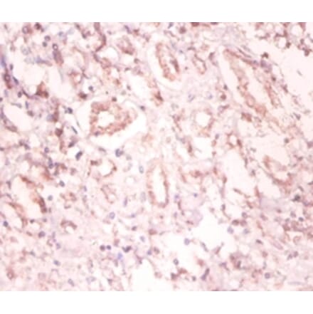 Immunohistochemistry - U1 small nuclear ribonucleoprotein A Polyclonal Antibody from Signalway Antibody (42190)