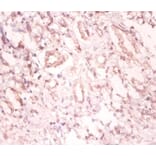 Immunohistochemistry - U1 small nuclear ribonucleoprotein A Polyclonal Antibody from Signalway Antibody (42190)