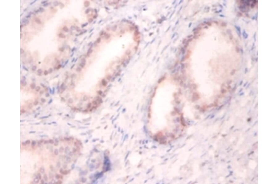 Immunohistochemistry - U1 small nuclear ribonucleoprotein A Polyclonal Antibody from Signalway Antibody (42190)