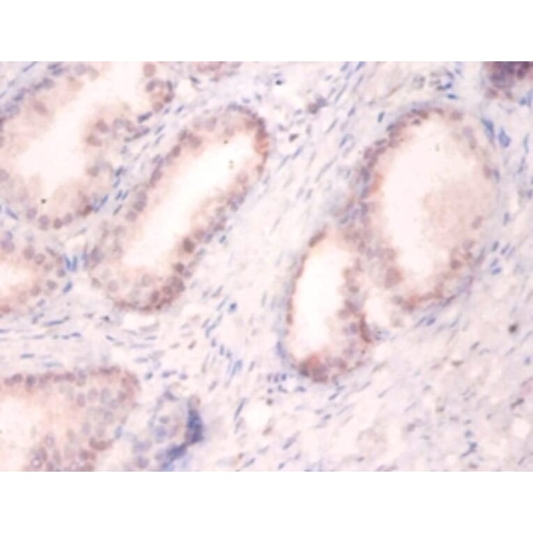 Immunohistochemistry - U1 small nuclear ribonucleoprotein A Polyclonal Antibody from Signalway Antibody (42190)