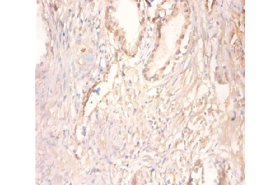 Immunohistochemistry - Creatine kinase U-type,mitochondrial Polyclonal Antibody from Signalway Antibody (42514)