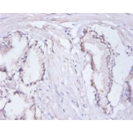 Immunohistochemistry - Replication protein A 14 kDa subunit Polyclonal Antibody from Signalway Antibody (42602)