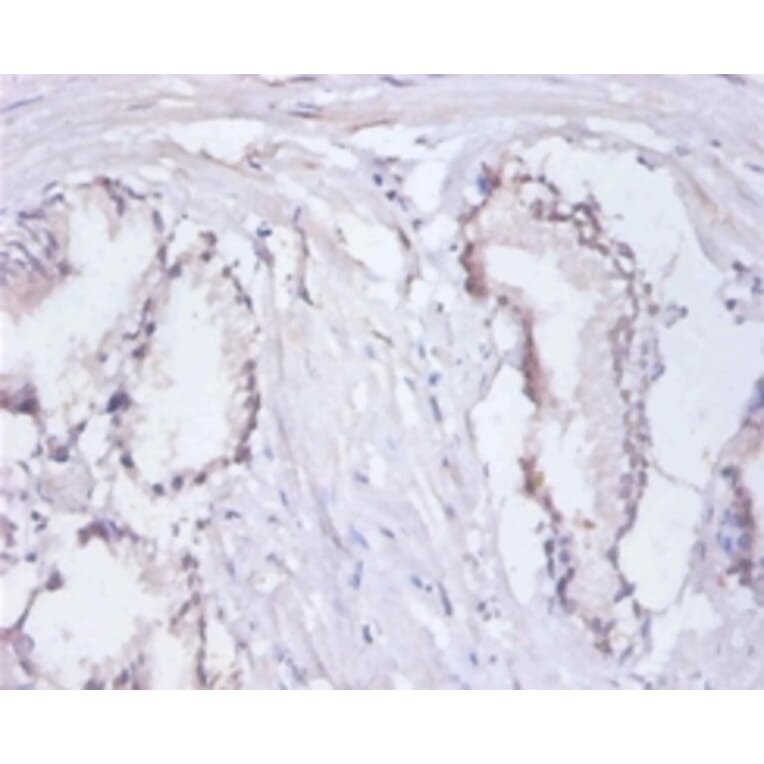 Immunohistochemistry - Replication protein A 14 kDa subunit Polyclonal Antibody from Signalway Antibody (42602)