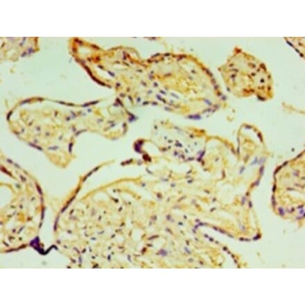 Immunohistochemistry - Prolyl 4-hydroxylase subunit alpha-3 Polyclonal Antibody from Signalway Antibody (42661)