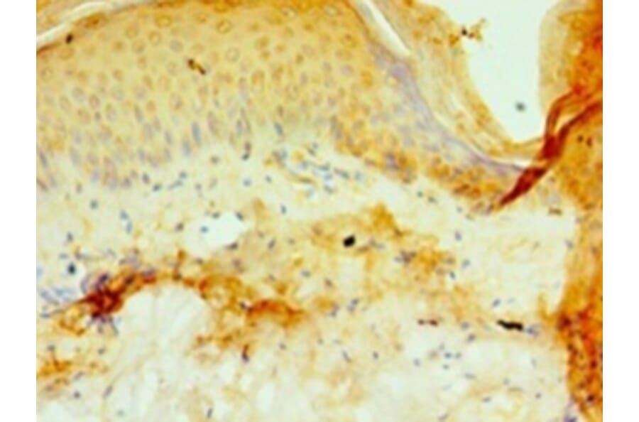 Immunohistochemistry - Prolyl 4-hydroxylase subunit alpha-3 Polyclonal Antibody from Signalway Antibody (42661)