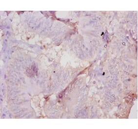 Immunohistochemistry - Muellerian-inhibiting factor Polyclonal Antibody from Signalway Antibody - Antibodies.com