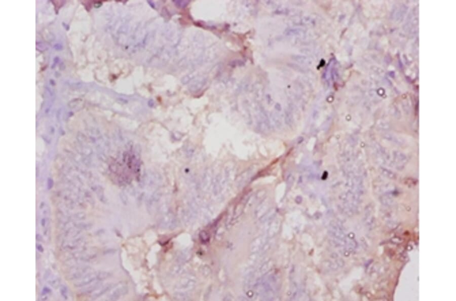 Immunohistochemistry - Muellerian-inhibiting factor Polyclonal Antibody from Signalway Antibody - Antibodies.com