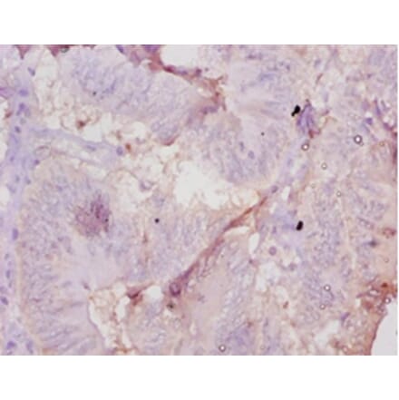 Immunohistochemistry - Muellerian-inhibiting factor Polyclonal Antibody from Signalway Antibody - Antibodies.com