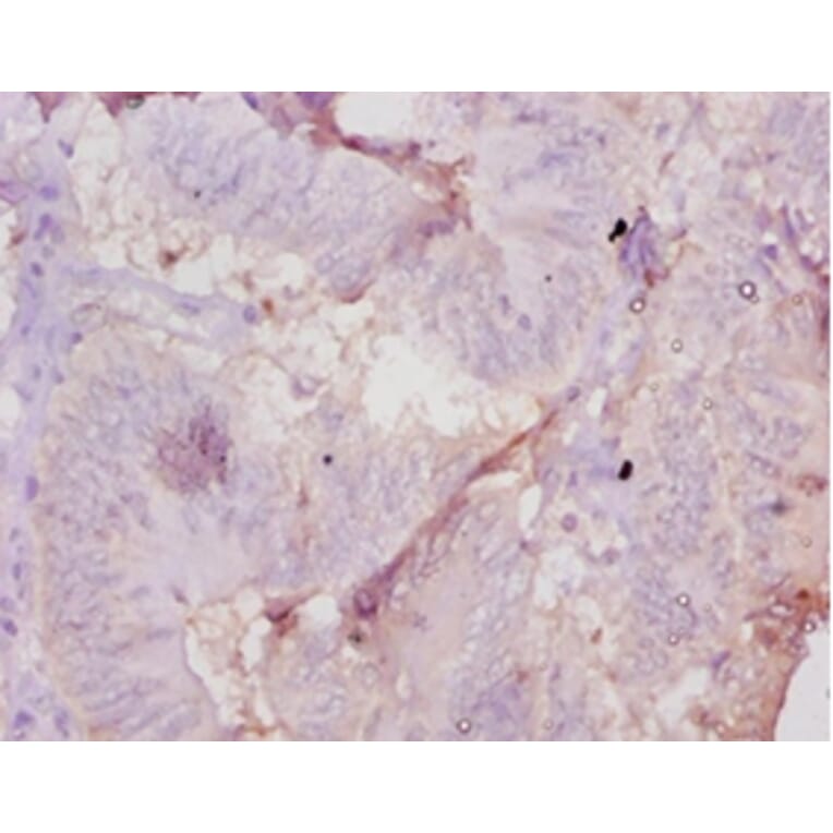 Immunohistochemistry - Muellerian-inhibiting factor Polyclonal Antibody from Signalway Antibody - Antibodies.com