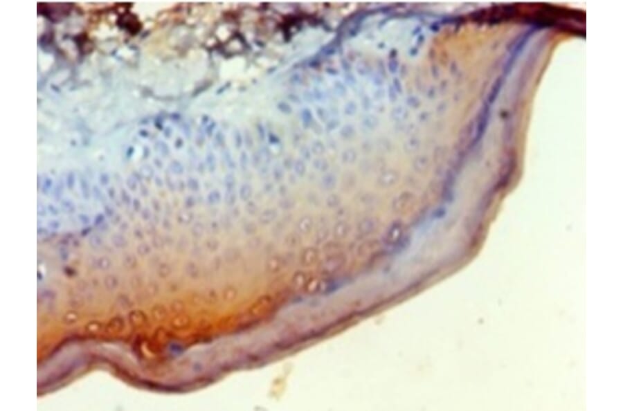 Immunohistochemistry - Leukocyte elastase inhibitor Polyclonal Antibody from Signalway Antibody - Antibodies.com