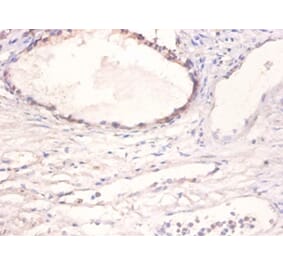 Immunohistochemistry - Bone morphogenetic protein 2 Polyclonal Antibody from Signalway Antibody - Antibodies.com