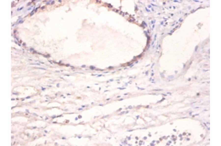 Immunohistochemistry - Bone morphogenetic protein 2 Polyclonal Antibody from Signalway Antibody - Antibodies.com