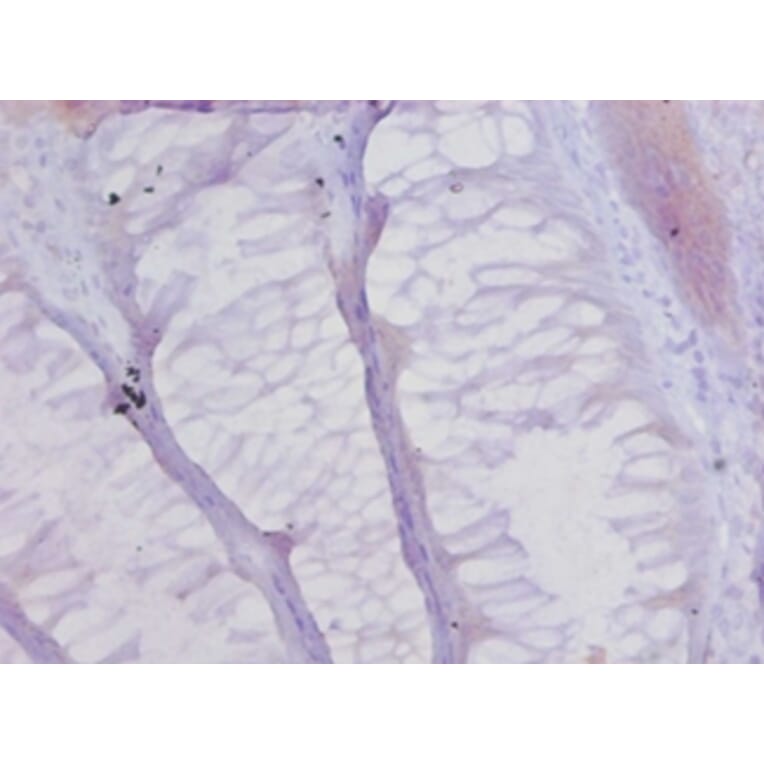Immunohistochemistry - Collagen alpha-1 (XVII) chain Polyclonal Antibody from Signalway Antibody - Antibodies.com