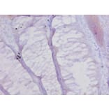Immunohistochemistry - Collagen alpha-1 (XVII) chain Polyclonal Antibody from Signalway Antibody - Antibodies.com