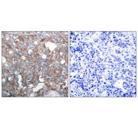 Immunohistochemistry - Cortactin (Ab-421) Antibody from Signalway Antibody (21263) - Antibodies.com