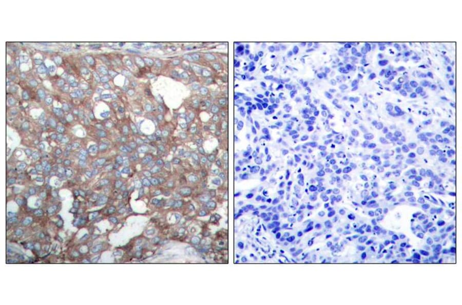 Immunohistochemistry - Cortactin (Ab-421) Antibody from Signalway Antibody (21263) - Antibodies.com