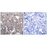 Immunohistochemistry - Cortactin (Ab-421) Antibody from Signalway Antibody (21263) - Antibodies.com