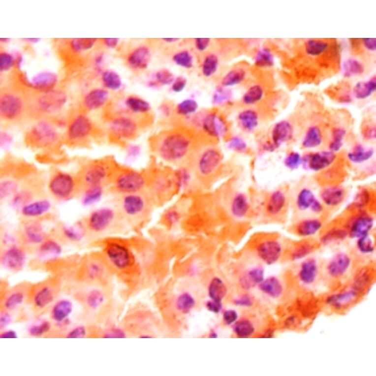 Immunohistochemistry - Midkine Polyclonal Antibody from Signalway Antibody (42524) - Antibodies.com