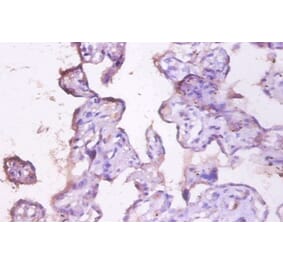 Immunohistochemistry - Mucin-1 Polyclonal Antibody from Signalway Antibody (42535) - Antibodies.com