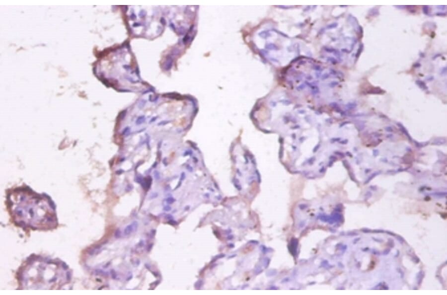Immunohistochemistry - Mucin-1 Polyclonal Antibody from Signalway Antibody (42535) - Antibodies.com