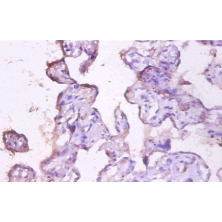 Immunohistochemistry - Mucin-1 Polyclonal Antibody from Signalway Antibody (42535) - Antibodies.com