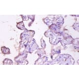 Immunohistochemistry - Mucin-1 Polyclonal Antibody from Signalway Antibody (42535) - Antibodies.com