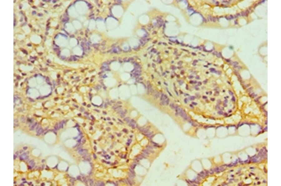 Immunohistochemistry - HTATIP2 Polyclonal Antibody from Signalway Antibody (42676) - Antibodies.com