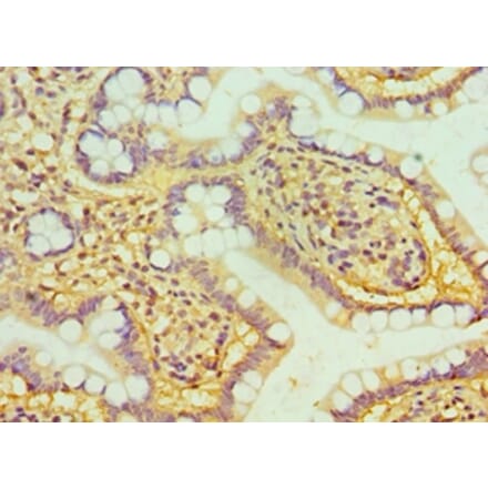 Immunohistochemistry - HTATIP2 Polyclonal Antibody from Signalway Antibody (42676) - Antibodies.com