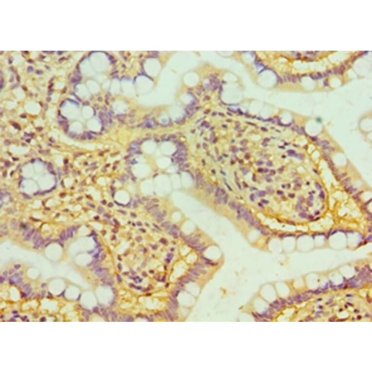 Immunohistochemistry - HTATIP2 Polyclonal Antibody from Signalway Antibody (42676) - Antibodies.com