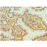 Immunohistochemistry - HTATIP2 Polyclonal Antibody from Signalway Antibody (42676) - Antibodies.com