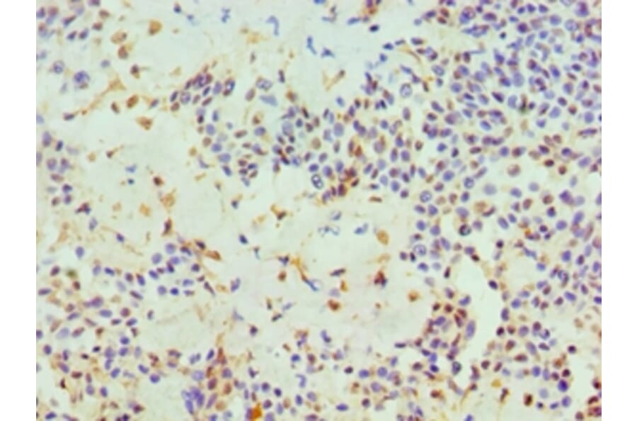 Immunohistochemistry - HTATIP2 Polyclonal Antibody from Signalway Antibody (42676) - Antibodies.com