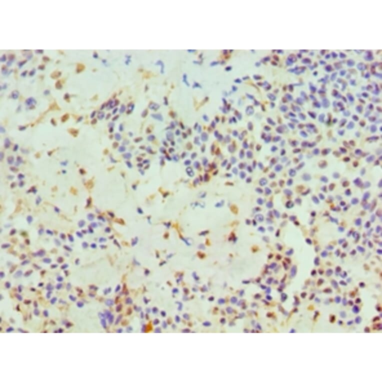 Immunohistochemistry - HTATIP2 Polyclonal Antibody from Signalway Antibody (42676) - Antibodies.com