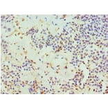 Immunohistochemistry - HTATIP2 Polyclonal Antibody from Signalway Antibody (42676) - Antibodies.com