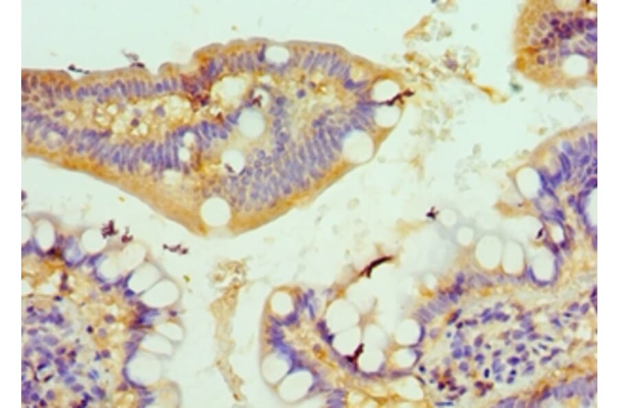 Immunohistochemistry - CSRP2BP Polyclonal Antibody from Signalway Antibody (42686) - Antibodies.com
